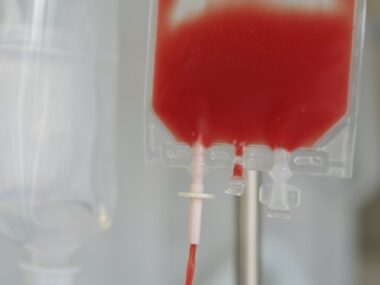 blood transfusions