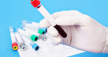 blood typing