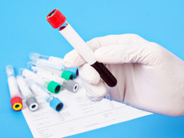 blood typing