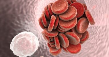 AIHA and thrombotic events