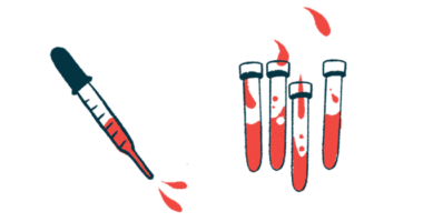 incidental CAD | Cold Agglutinin News | illustration of blood in syringe and test tubes
