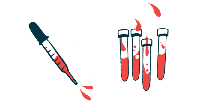 Illustration of blood in a pipette and test tubes.