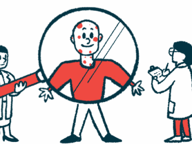 A doctor holds a gigantic magnifying glass over a person with a rash, while another physician looks on, taking notes.