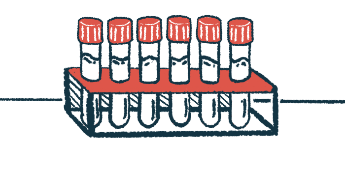 An illustration shows a row of vials.