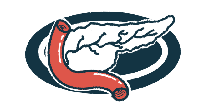 An illustration shows a close-up view of the human pancreas.